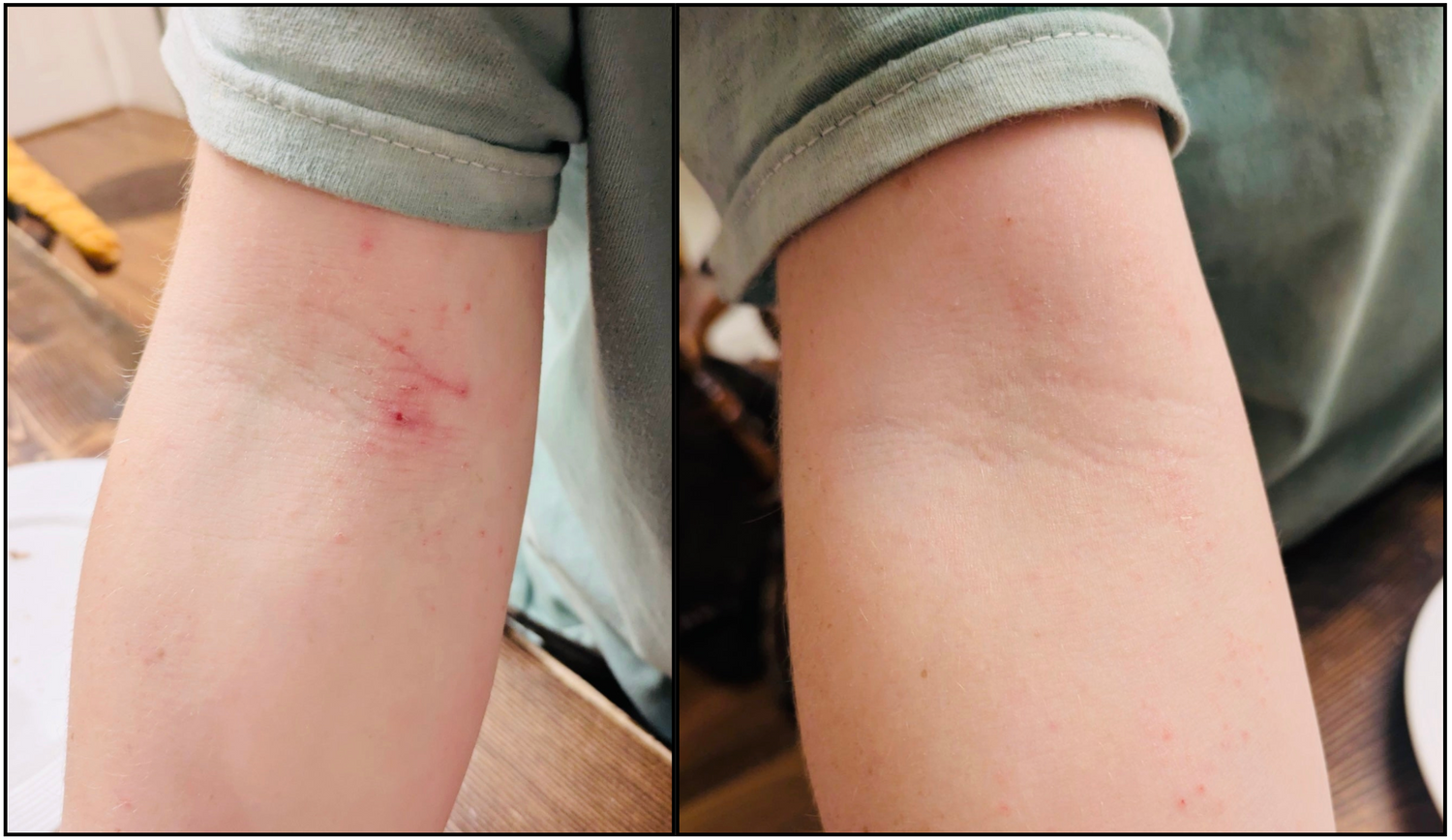 Before and After - Healing Tallow Balm
